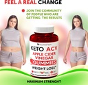 keto-acv-gummies-advanced-weight-loss----3.jpg