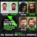beard-growth-kit-wgrow-xxl-beard-oilseru-6.jpg